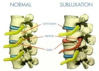 Chiropractic
